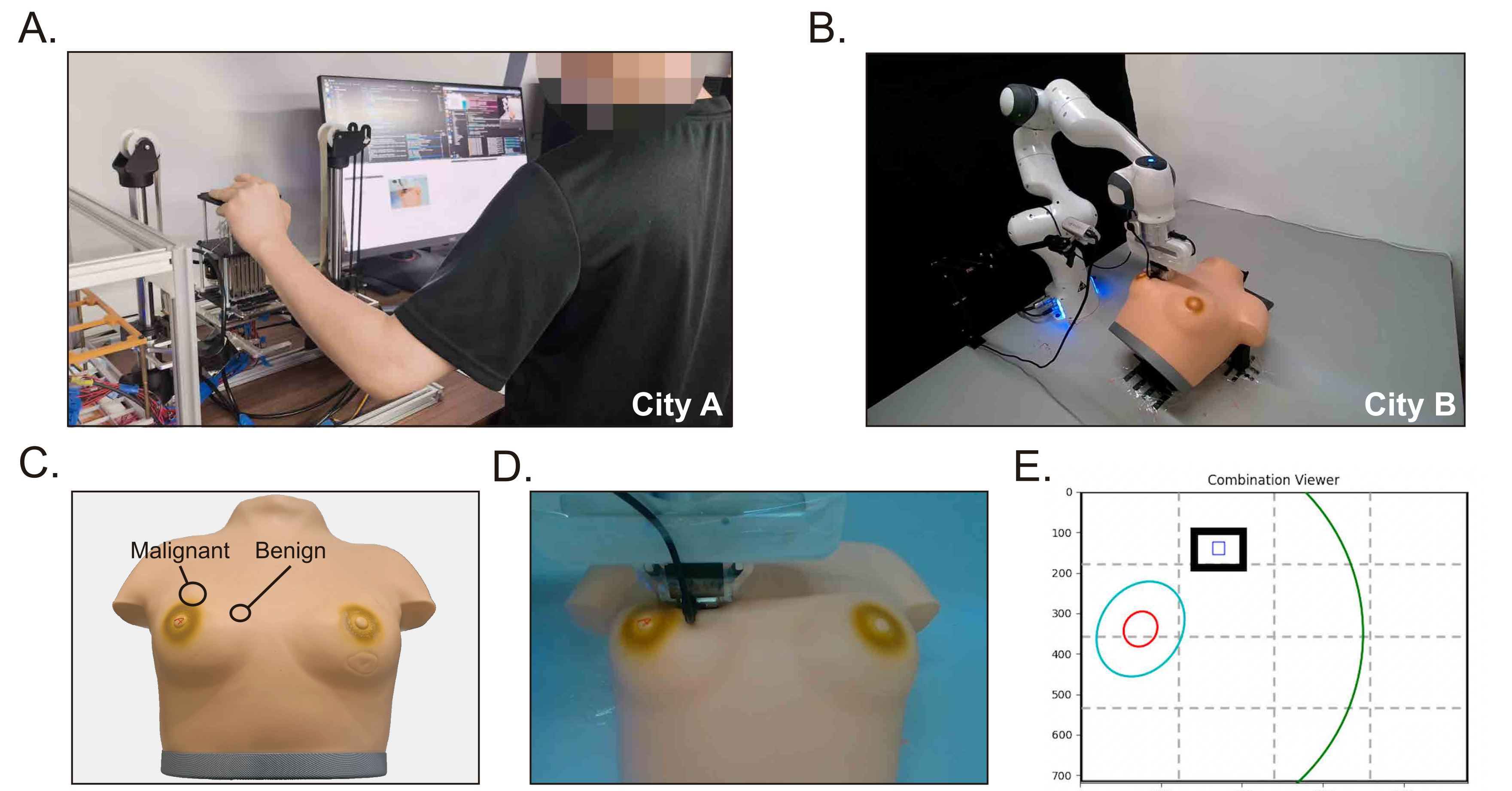 Cross-city remote breast tumor palpation experiment and user experience evaluation